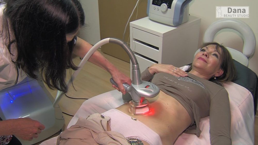 Lipomassage to remove fat  actress Misa Dolinova, Prague 9, Dana Clinic