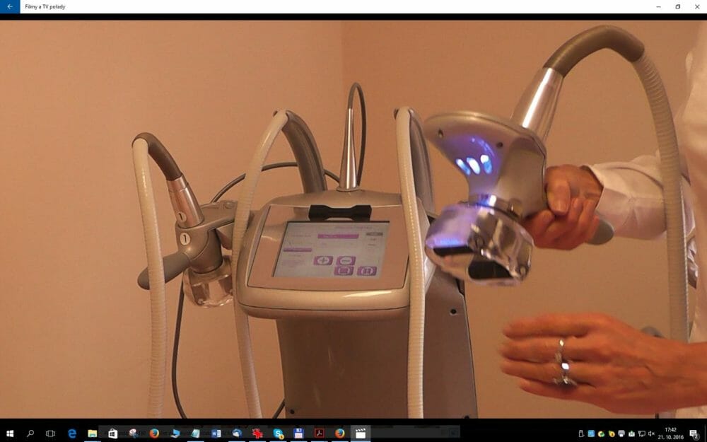 Lipomassage to remove fat.  Vacum device is used also for lipomassage cellulite removal. Prague
