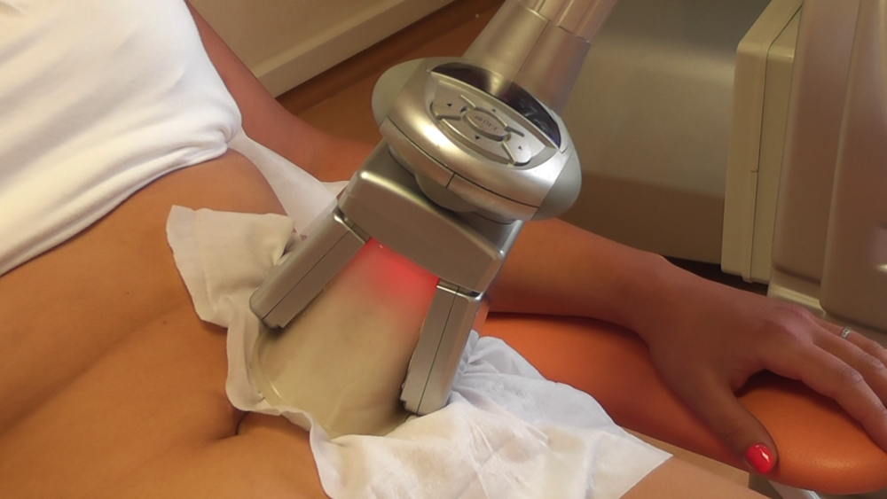 Cryolipolysis freezing of fat cells, by treatment, non-invasive liposuction without surgery, Prague 9, 